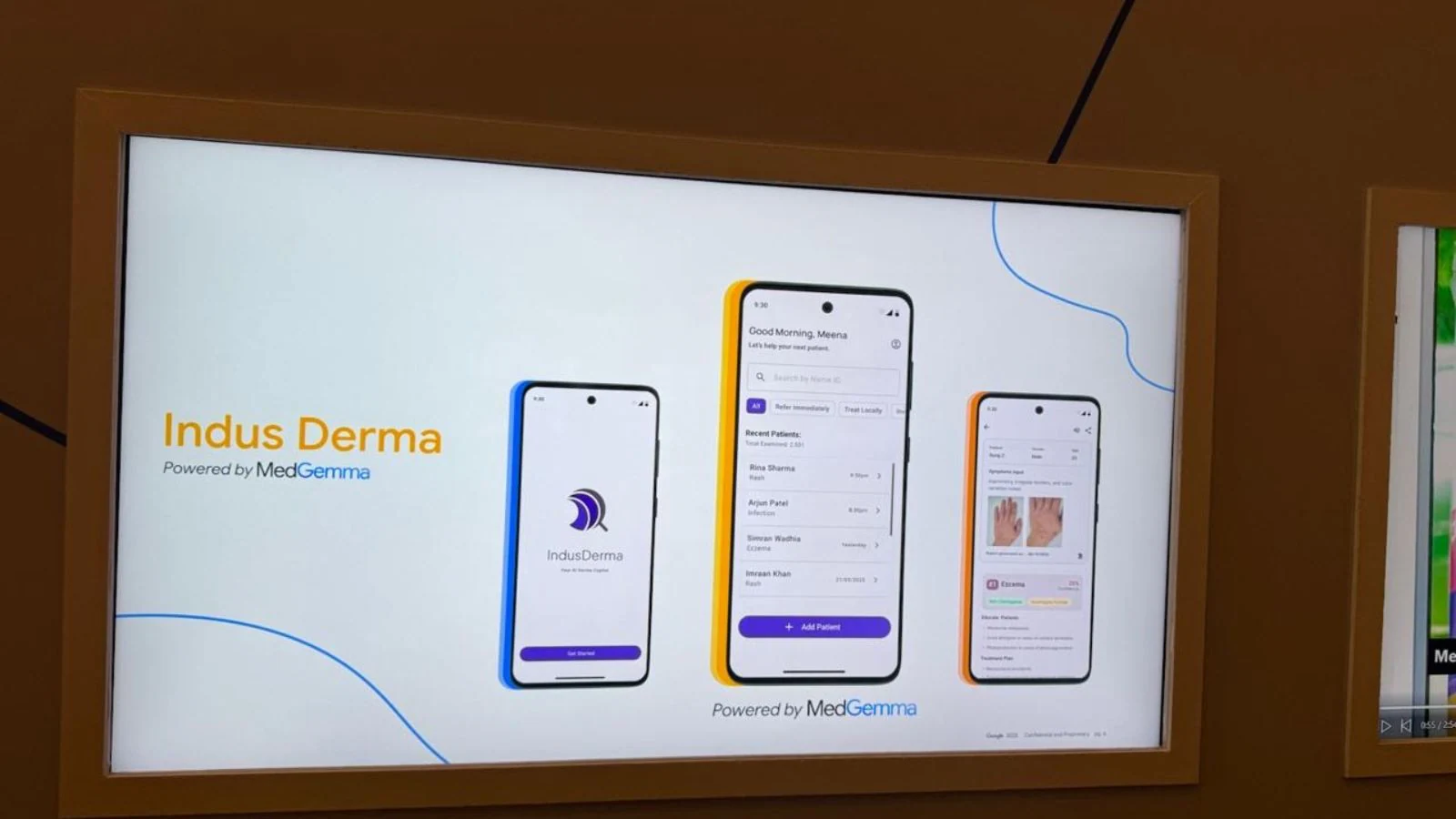AIIMS और Google ने त्वचा देखभाल तक पहुंच बढ़ाने के लिए AI-संचालित ऐप विकसित किया: जब आसपास कोई त्वचा विशेषज्ञ न हो तो आपकी तस्वीर कैसे मदद कर सकती है